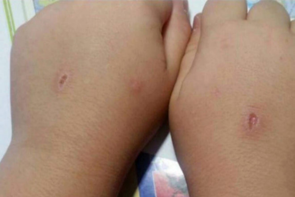 Así es 'El abecedario del diablo': el juego sádico que impone a los niños una herida por cada letra